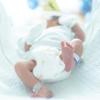 Why the HOPE Project Exists - newborn baby